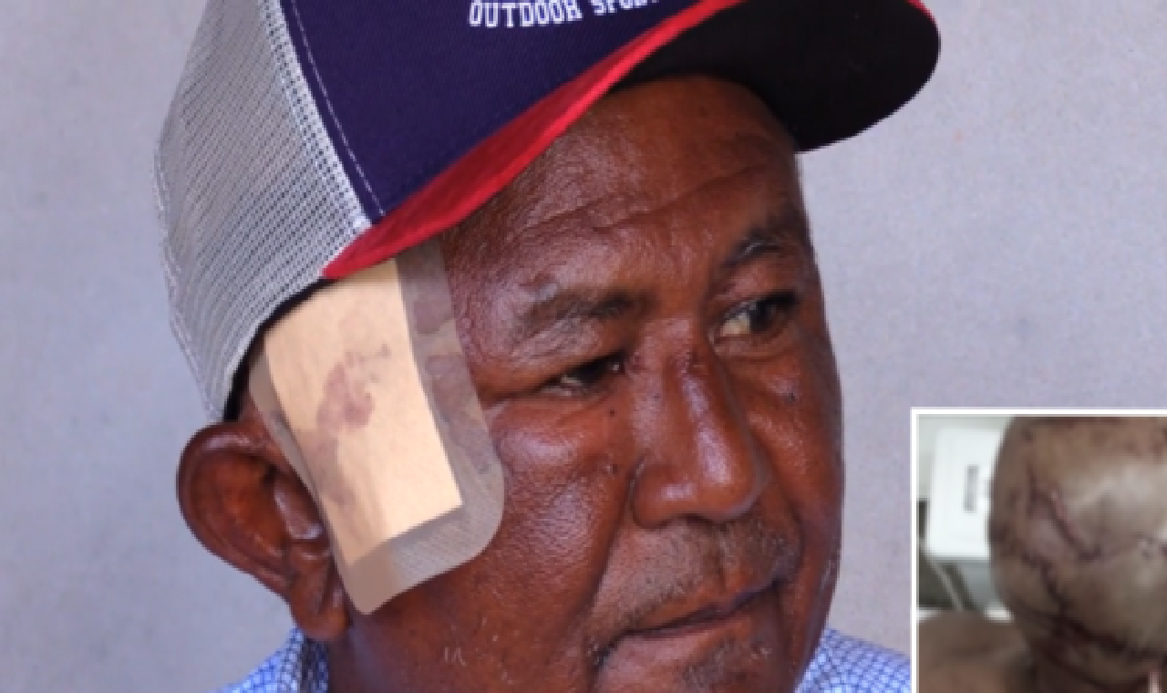 Índio é atacado por onça-pintada e sobrevive