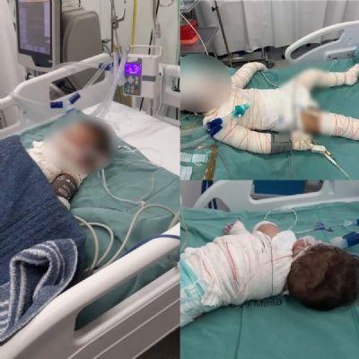LAMENTÁVEL: Criança de 3 anos morre 12 dias após explosão de churrasqueira que matou irmão e deixou mãe em estado grave em MT