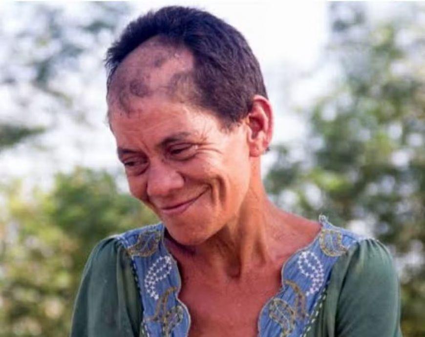 Mulher em situação de rua que morreu atropelada ajudava pessoas a atravessarem avenida em segurança em Cuiabá