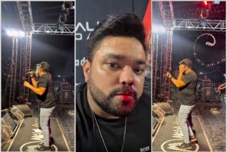 Cantor de forró que foi agredido em show na cidade de Luciara (MT) desabafa: “Foi tenso”