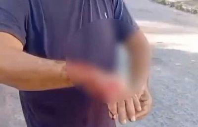 Homem fica ferido e cadela é morta após ataque de pitbull em Barra do Garças (MT)