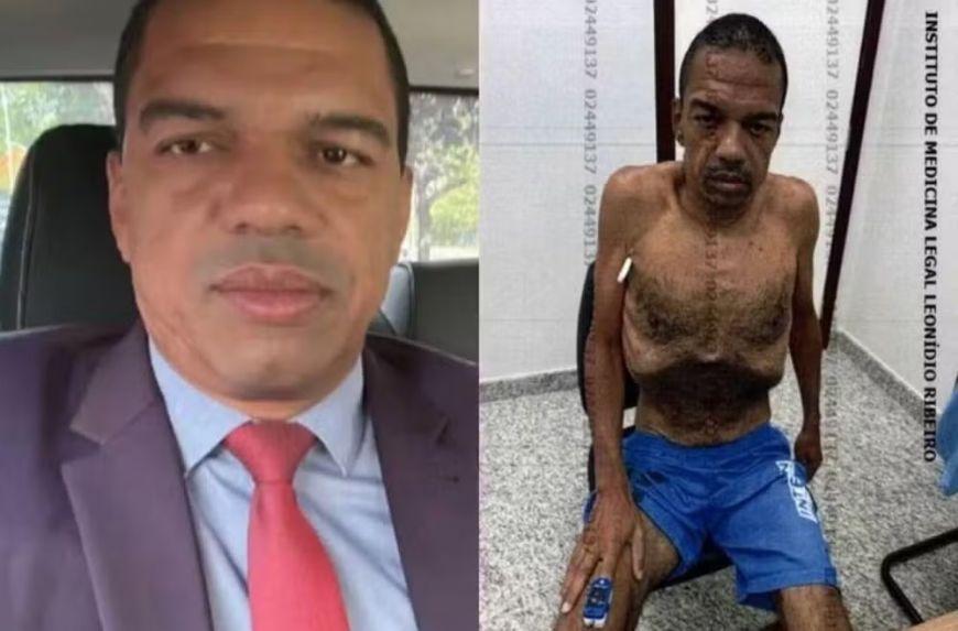 Por que o lobista Andreson perdeu mais de 30 kg na prisão: entenda a condição de saúde