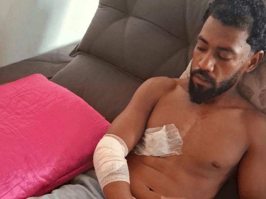 Trabalhador da coleta de lixo é brutalmente atacado por pitbull em Canarana (MT) durante serviço