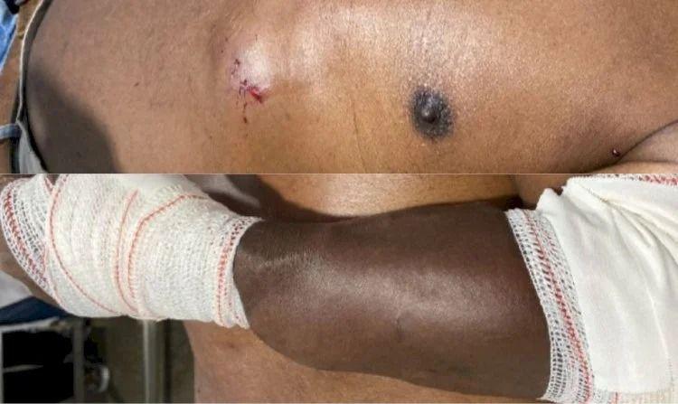 Idoso é espancado com pedaço de madeira em Canarana (MT) após tentar defender o próprio cachorro