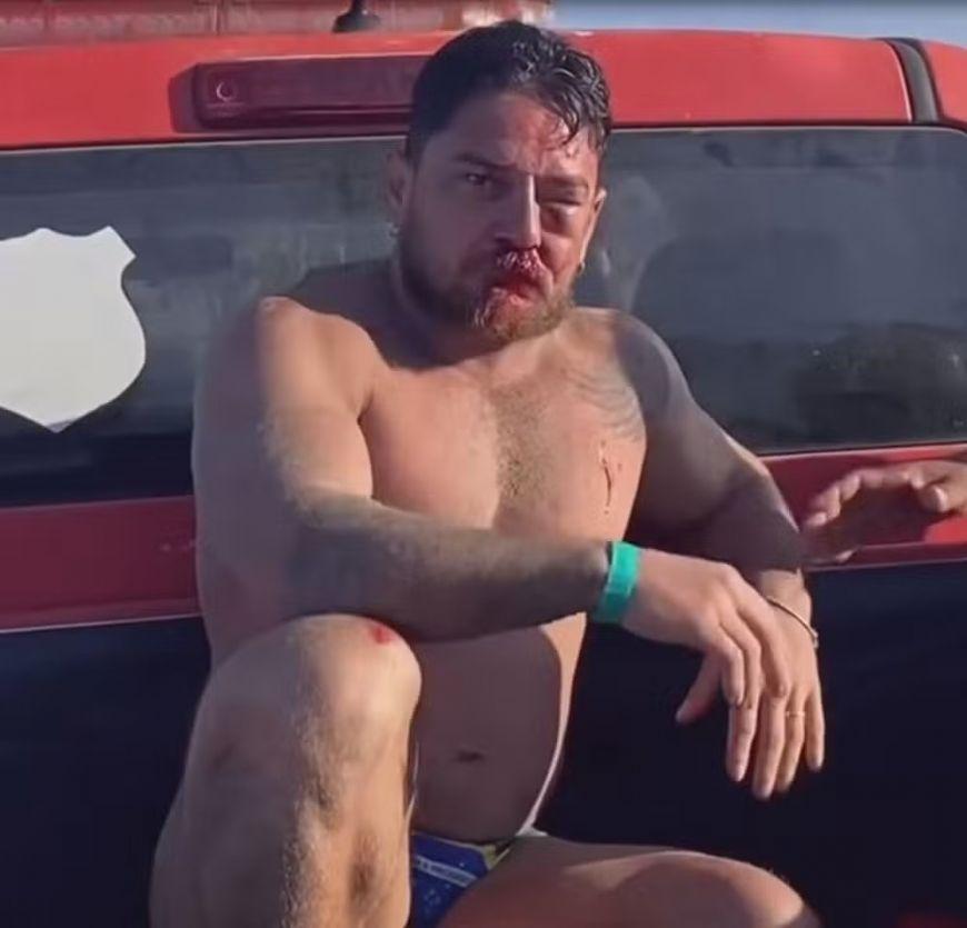 Casal de turistas de MT é agredido em Porto de Galinhas após cobrança por uso de cadeiras de praia: 'Eu vi a morte na nossa frente'